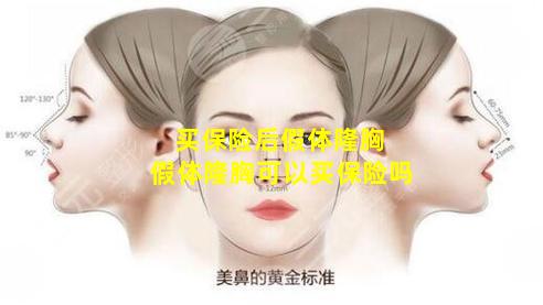 买保险后假体隆胸 假体隆胸可以买保险吗